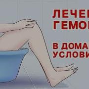 Уй Шароитида Гемаройни Даволаш Фойдали Маслахатлар