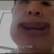 医疗反腐虎头蛇尾