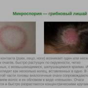 Биомедис М Грибки Паразиты