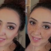 Sepkillarni Yo Qotish Usullari Сепкилларни Йукотиш Усуллари Веснушки