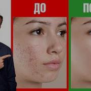 Лечение Кожи