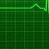 Human Heart Beating Animation Green Screen With Sound Effects Download Link In Description