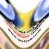Happy Klasky Csupo Robot Logo Effects 5