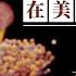 煙麴菌 致命真菌入侵美國急速擴散 從內部吞噬人體 星島頭條新聞 國際 傳染病 真菌 麴菌病 美國南部 肺部感染 孢子 世界衛生組織