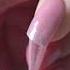 Speed Up Removal Time By Clipping Off The Bulk Like This First Before Filing