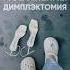 Димплэктомия или хирургические ямочки на щечках ямочкинащечках ямочки пласикалица