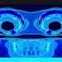 Klasky Csupo In G Major 6027 Has A Sparta Gamma Remix
