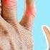Eat This To Heal Rheumatoid Arthritis Without Medication
