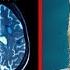 How To Build Extreme Discipline Using Micro Sucks Neuroscientist Andrew Huberman