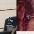 III конгресс ОСОК Tan Ker Kan Laparoscopic CME Learning Points
