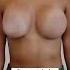 Conquiste Corpo Acesse Https Fans Link Danielbotelhoplastica
