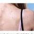 How To Get Rid Of Body Acne Naturally At Home Natural Body Wash Bodyacne