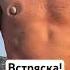 Камень попал в сердце он выжил