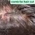 Haircare Tips For Scalp Follicultis Shorts