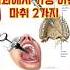 가장 아픈 마취 2가지 신경치료 근관치료 충치 사랑니발치