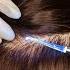 АСМР Детальный осмотр кожи головы ДЛЯ 100 РАССЛАБЛЕНИЯ И СНА ASMR Detailed Scalp Exam