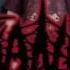 Kraanium Sodomie Lacerate And Murder