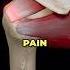Fix Rotator Cuff Pain From The Supraspinatus Fixshoulderpain Shoulderinjury