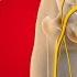 The Vitamin Deficiency That Is KILLING Your Sciatica Nerve