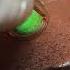 BIKINI HAIR REMOVAL SEV LASER