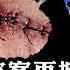 羅帥宇官方五大破綻難自圓其說 爆紅熱搜 微信解封 中共活摘20年罪證失控 習近平為何壓不住了 體制內部開始鬆動 1119頁資料 錄音與舉報紀錄全文分析 江峰漫談20250616第1080期