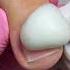 ПЛЕНОЧНЫЙ ПЕДИКЮР педикюр маникюр Nailart Nails длинныеногти ногтисаратов ногти