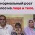 Человек Волк
