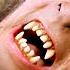 An American Werewolf In London The Transformation