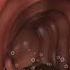 How Your Body Turns Food Into Poop The Digestive Journey Shorts Viralvideo Creativelearning3d