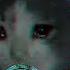 ПОДВОДНЫЕ СТРАДАНИЯ BAROTRAUMA