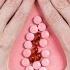 فض غشاء البكارة Hymenectomy