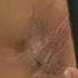 Dark Underarms Killing Your Confidence Dr Ashima Goel Dermatologist Chandigarh Mohali Shorts