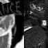 ONE CHANCE X METAMORPHOSIS 3 SLOWED REVERB Mar Agent69 Mashup
