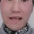 브베 극대노