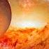 What Is The ORIGIN Of All MASS In The Universe Physics Of Symmetry Breaking