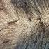 Remove Many Lice From Brown Hair Plucking Most Of Lice From Head
