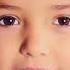Lice Removal Brooklyn Call Now 786 810 1435