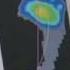 The Benefits Of Using A Foot Scanner In Podiatry