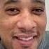 Crown After A Car Accident Smilemakeover Dentistteeth Dentist Dentition Viralreels Happysmile