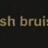 Bring Me The Horizon Fresh Bruises Lyric Video