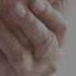 Possible Side Effects Of Aromatase Inhibitors Short Breastcancer