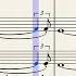 Rock Roll Part II The Hey Song From JOKER 2019 For String Quartet