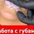 То что не расскажут другие Весь процесс увеличения губ уколыкрасоты косметология губы ботокс