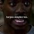 Eddie Murphy Herpes Simplex 10 I Beverly Hills Cop