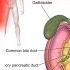 Pancreatitis Diet Chart In Hindi