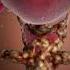 3D Animation Of Cervical Cancer 3D Animation Of Uterus