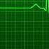 Human Heart Beats Animation Greenscreen Humanheartdiagram