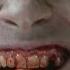 Bullseye Use His Tooth To Kill Daredevil Born Again Episode 8