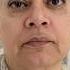 See Her Transformation Face Fitness Face Yoga Face Massage