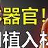 驚天醜聞 竊4000具屍體 倒賣器官 非法獲利80萬